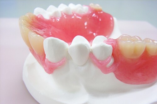 ノンクラスプデンチャー