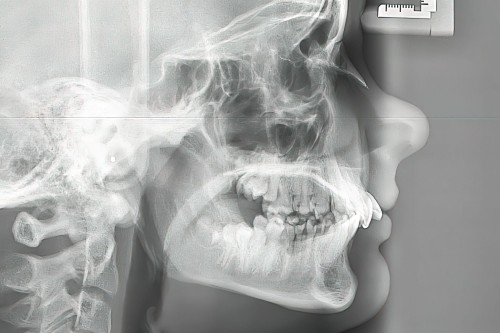 セファログラム